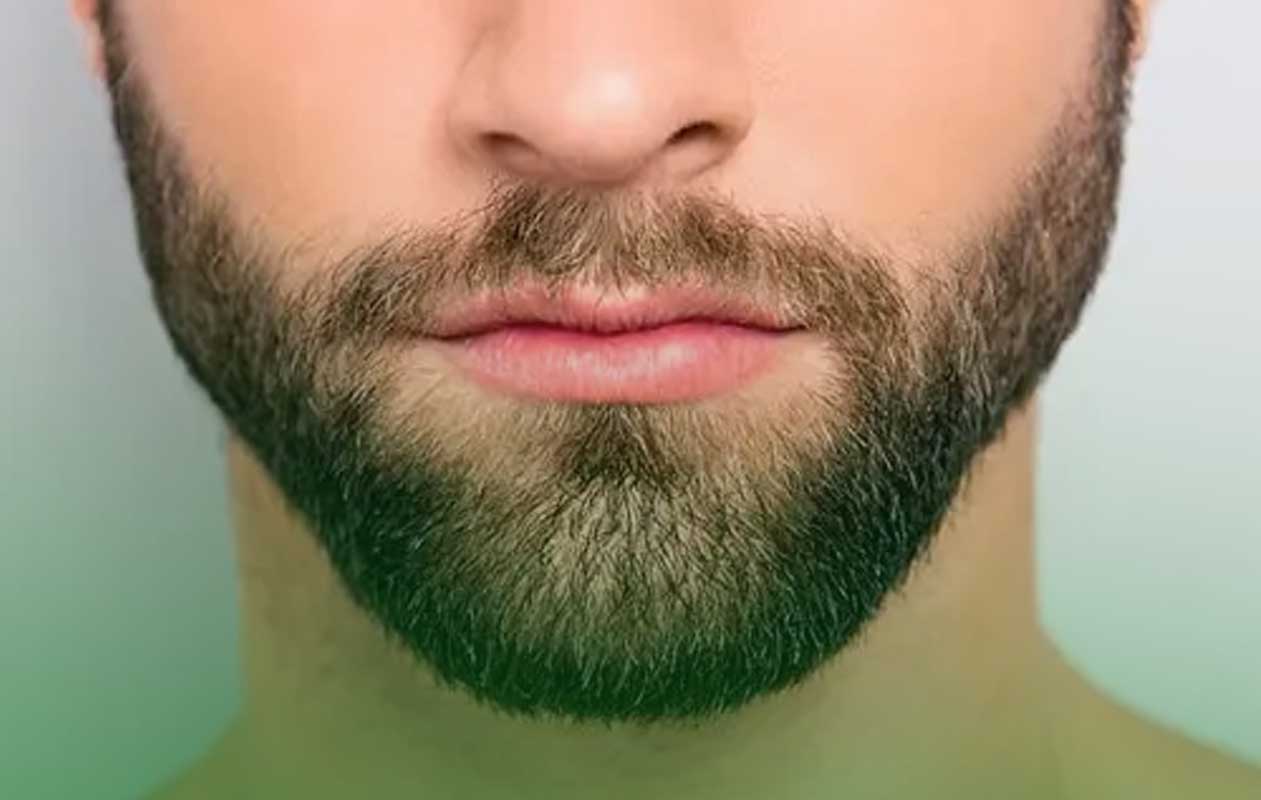 کاشت ریش
